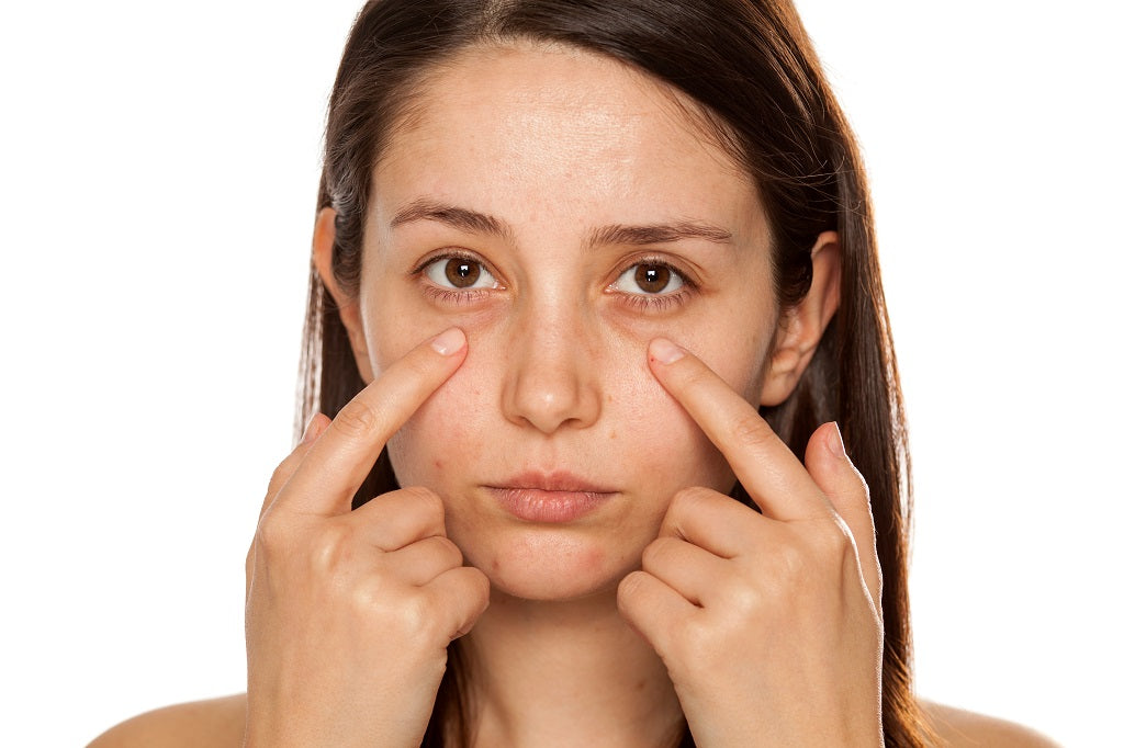 Vitamin c under eyes deals