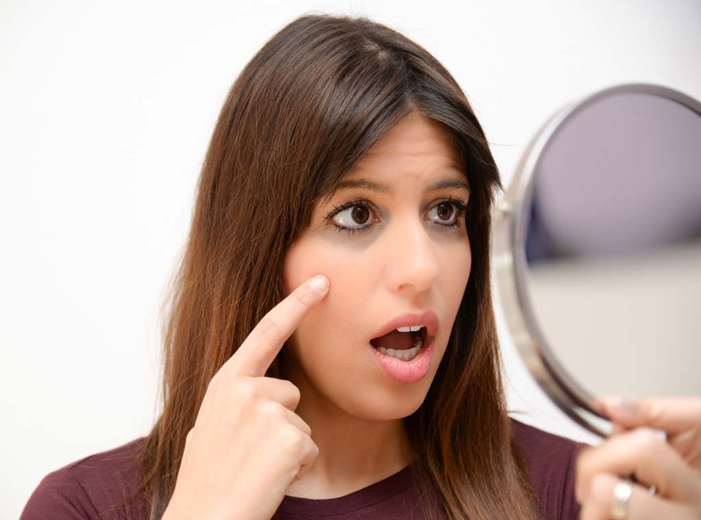 How to Get Rid of Dark Circles Using Castor Oil Naturally?