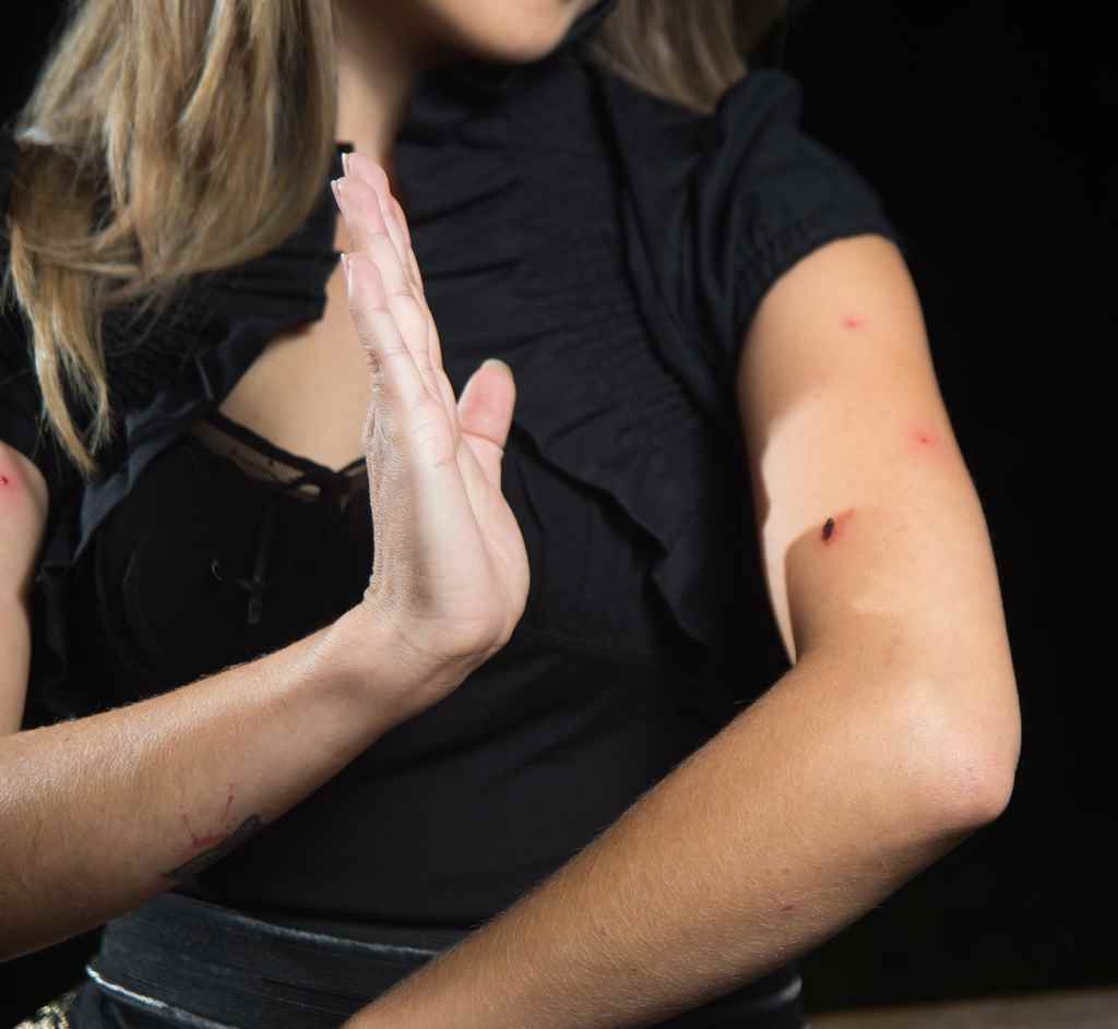 Home remedies for mosquito bites