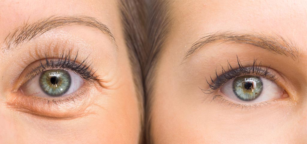 How to remove wrinkles