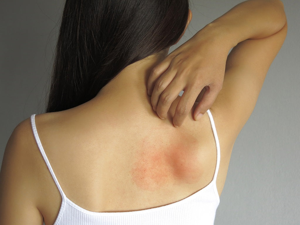 Shower online gel allergy