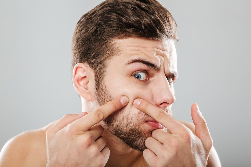 Zap That Zit: Top 10 Ingredients That Can Help Cure Adult Acne