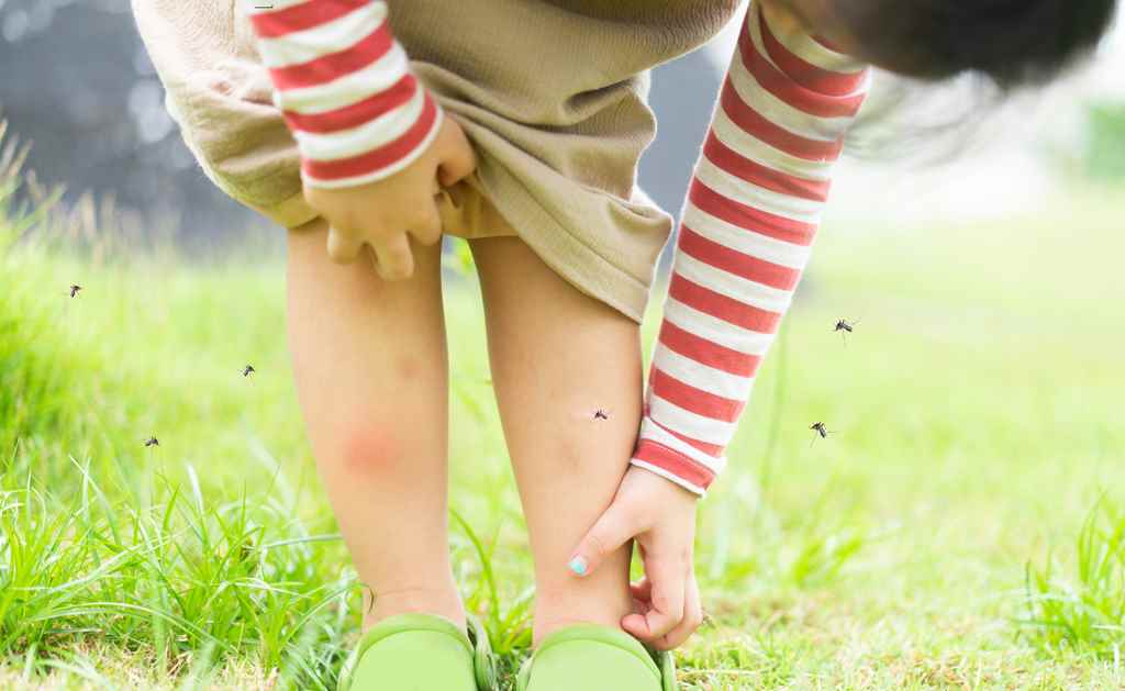 home remedies for insect bites