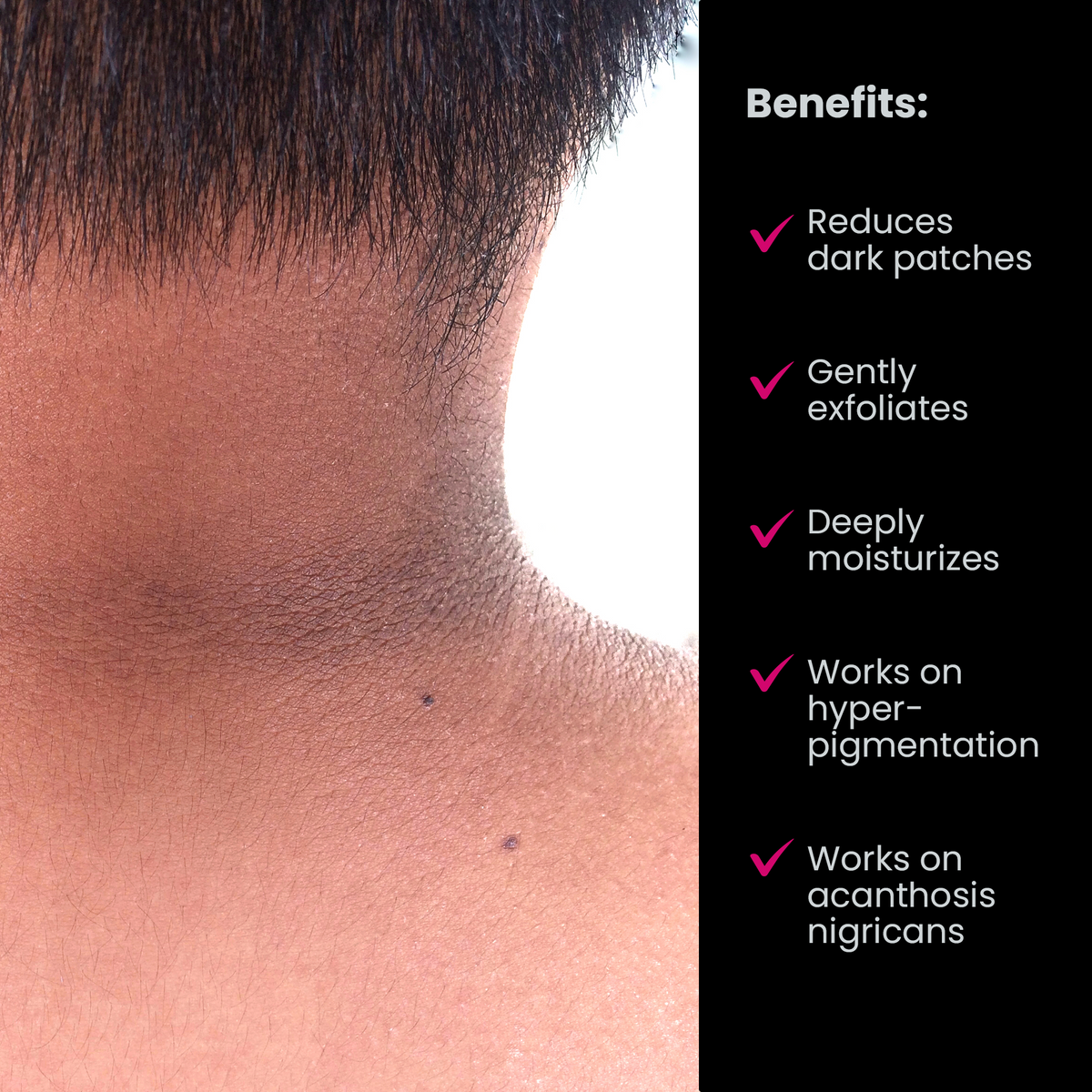 black patches on neck