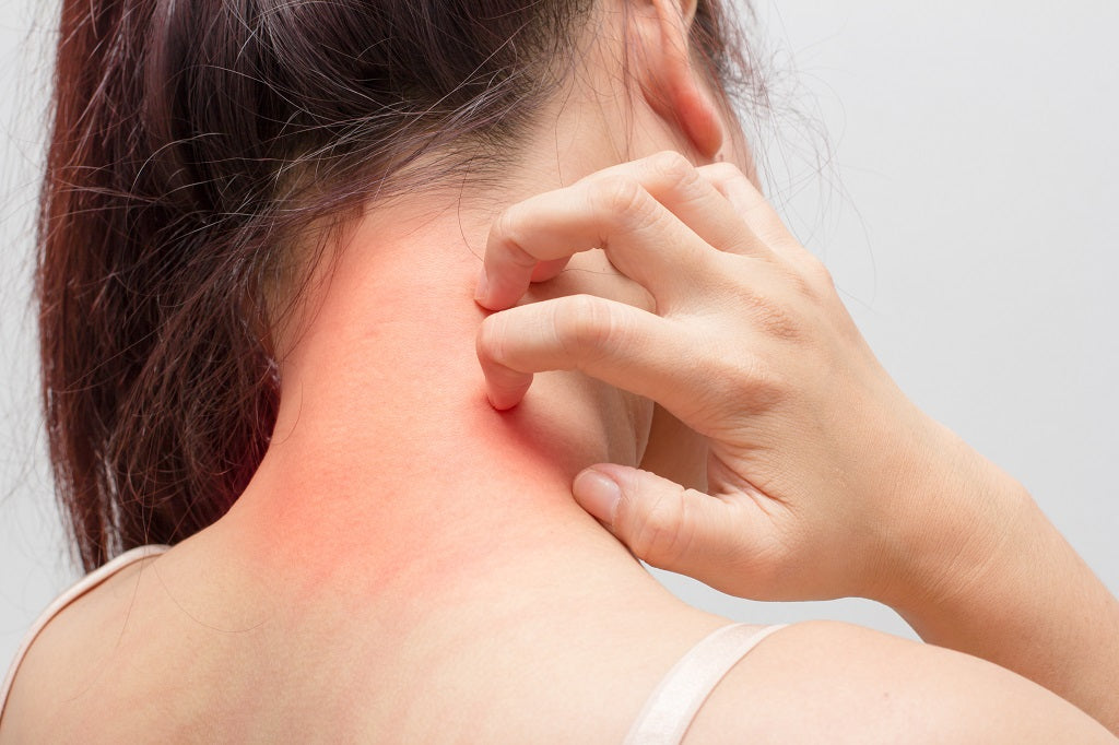 Itching (Pruritus) on Skin- Causes, Symptoms, Home Remedies and Preven