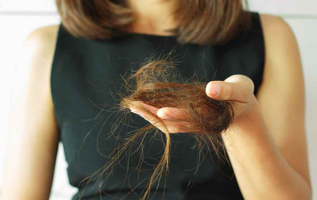 hair fall