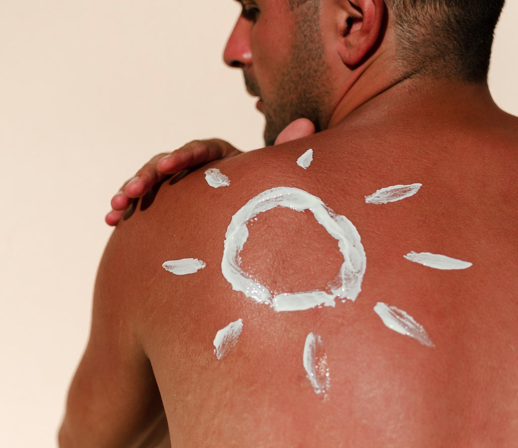 Sunburn - Causes, Symptoms and Treatments