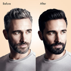 Anveya 5-Minutes Coloring Shampoo - Natural Black, 100ml