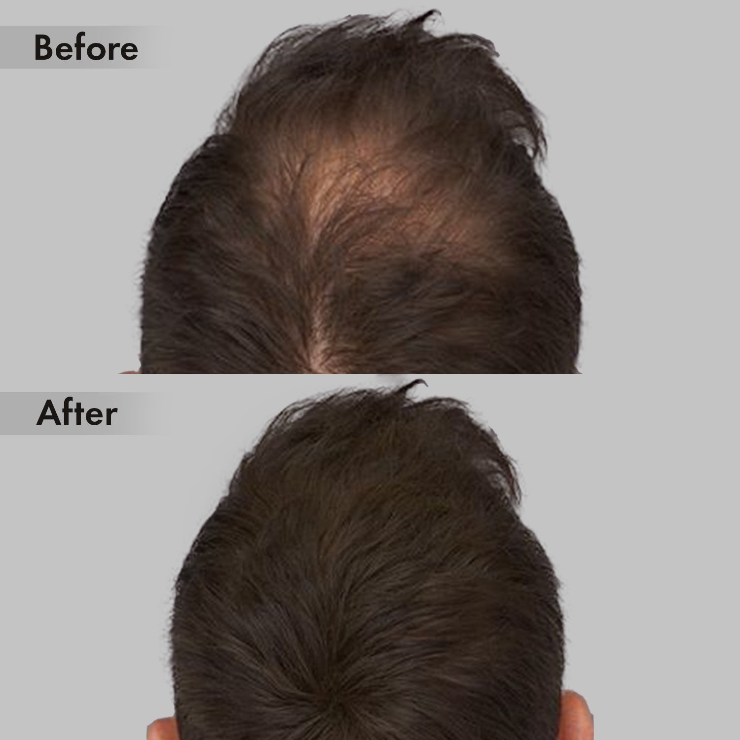 Anveya Advanced Hair Growth Serum,30ml