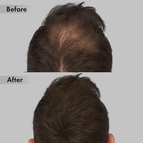 Anveya Advanced Hair Growth Serum,30ml