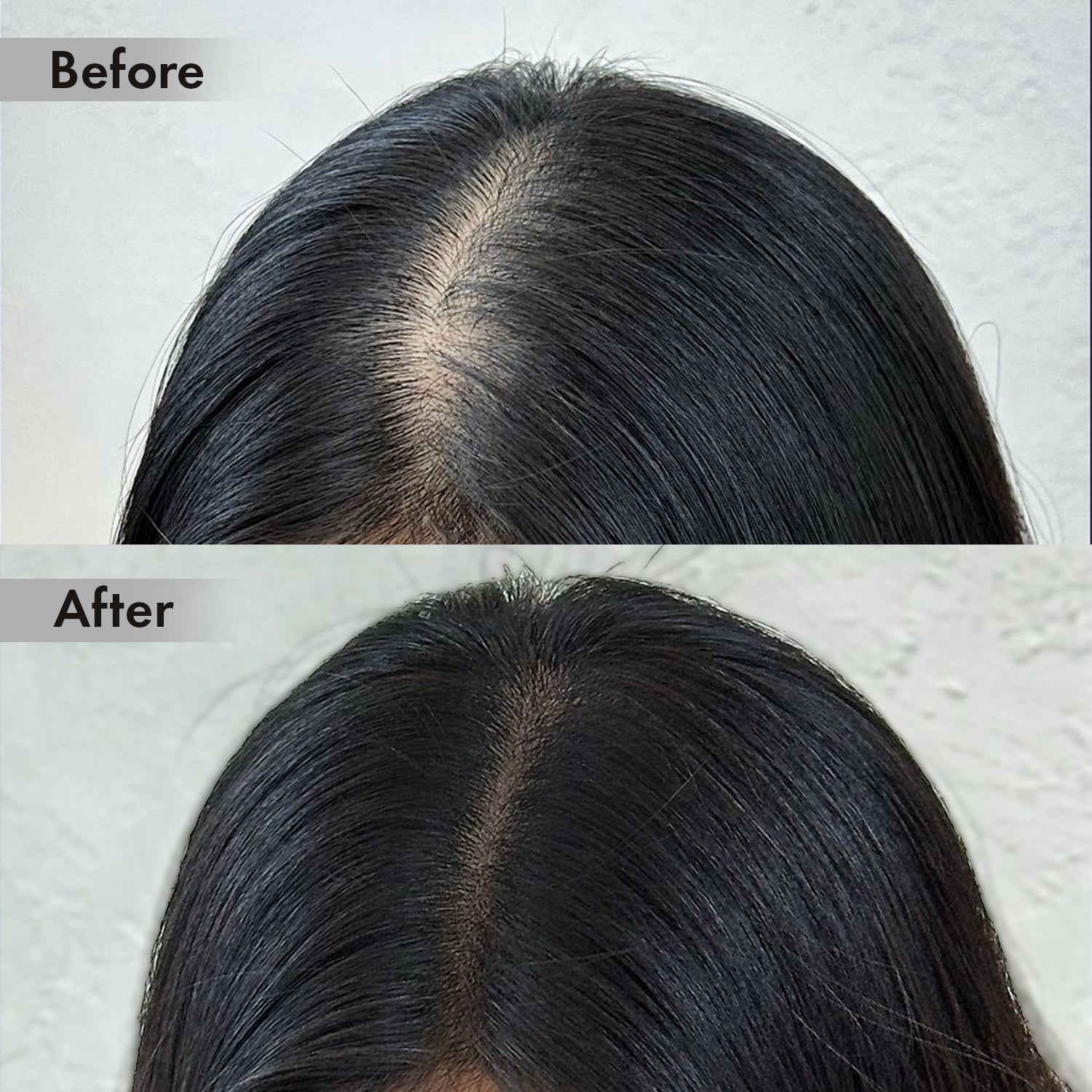 Anveya Advanced Hair Growth Serum,30ml