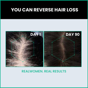 ThriveCo Hair Growth Serum 2.0, 50ml