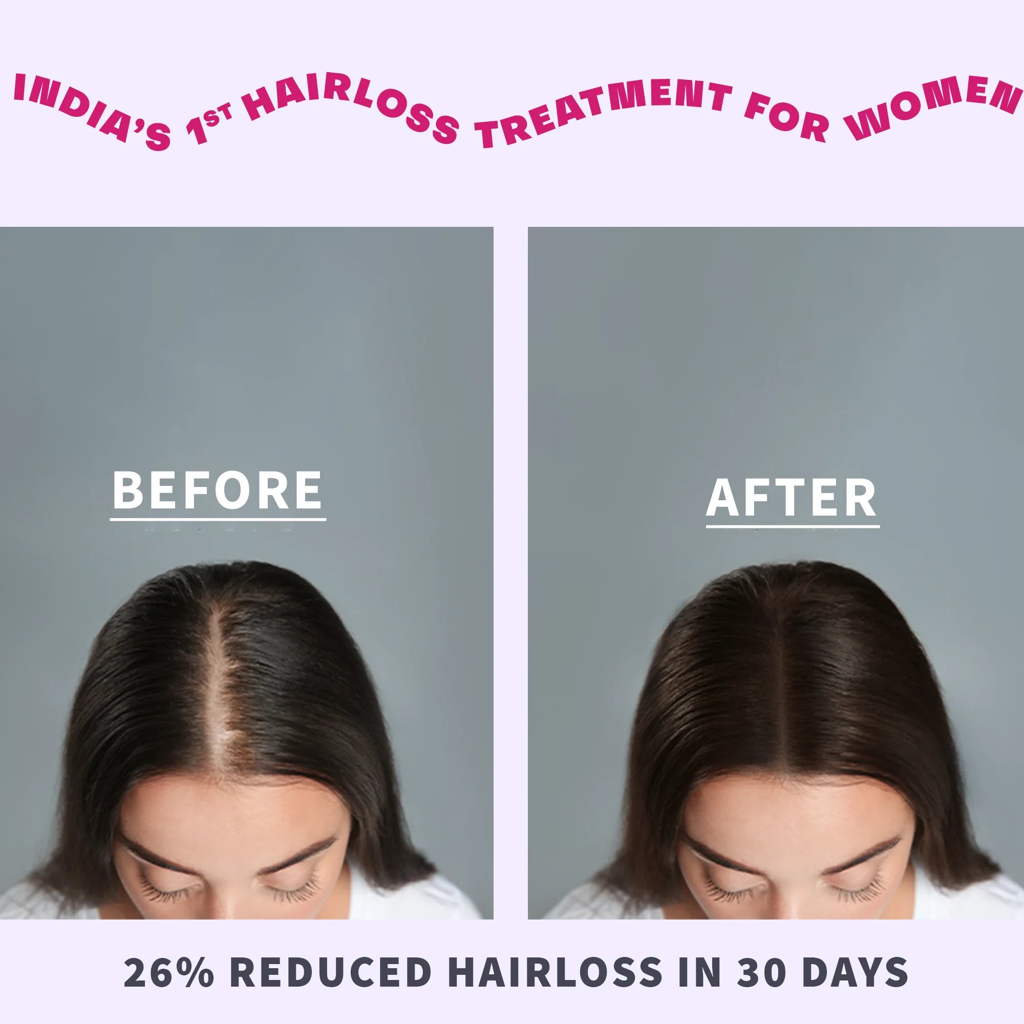 hair fall control serum