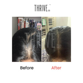 Hair Care Kit: ThriveCo Scalp Scrub (100ml) + Vitalizing Serum (50ml) + Hair Growth Serum (50ml)