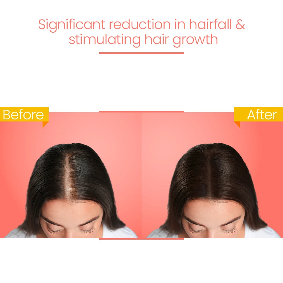 Roots Ban-the-Fall Serum, 120ml